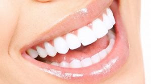 A smile with a perfectly shaped and white teeth