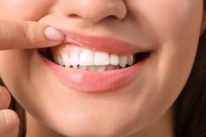 How To Stop Gums from Bleeding